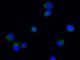 Cellule K562 marcate con colorante Hoechst che colora i nuclei di blu e trattate con composto di sintesi fluorescente nel verde.