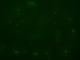 Cellule umane Hep3B trattate con un composto di sintesi recante fluorescenza nel verde (microscopio Nikon a fluorescenza).